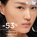Bioderma Sebium Kerato+ - 30 ML (Moisturizer Cream, Pimples Balckheads Removing cream)